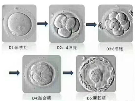 美国试管哪些条件下不适合鲜胚移植呢？