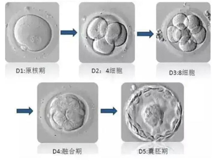 为什么美国试管婴儿中会出现养囊失败?