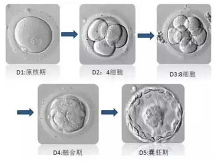 去美国做试管婴儿需要在美停留多长时间？