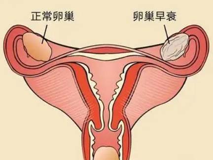 美国试管婴儿：80、90后的卵巢功能一旦衰退，还有救吗？