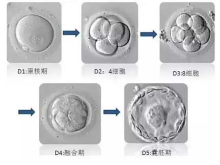 试管婴儿的移植方式有哪些?试管移植步骤!